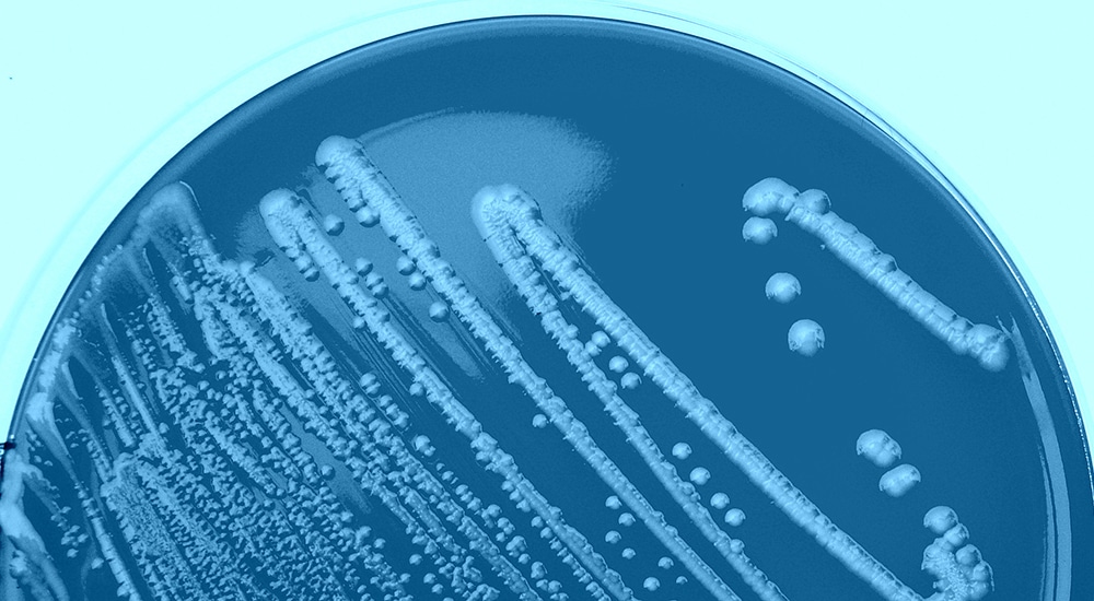 Mécanismes de tolérance d’une bactérie pathogène lors de la contamination d’aliments solides